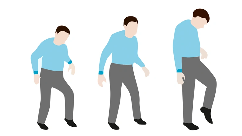 Epilepsy and Seizures